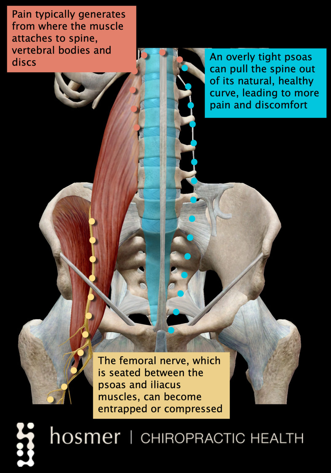 Hosmer Chiropractic Presenting: the Hosmer Highlight of the Month